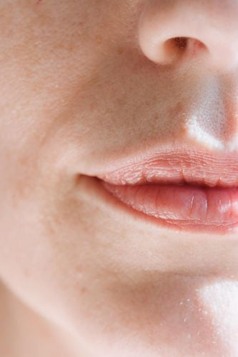 Mouth Taping: Benefits, Drawbacks, and Should You Try It?