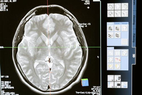 Why Life Decisions Can Feel Overwhelming in Your Early 20s: Blame Your Frontal Lobe
